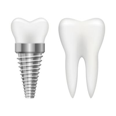 dental implant Scarborough
placing a dental implant
implant
Dentist in Scarborough