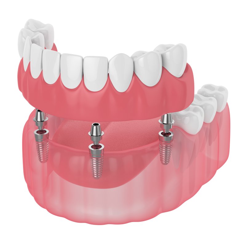 Dentures In Scarborough