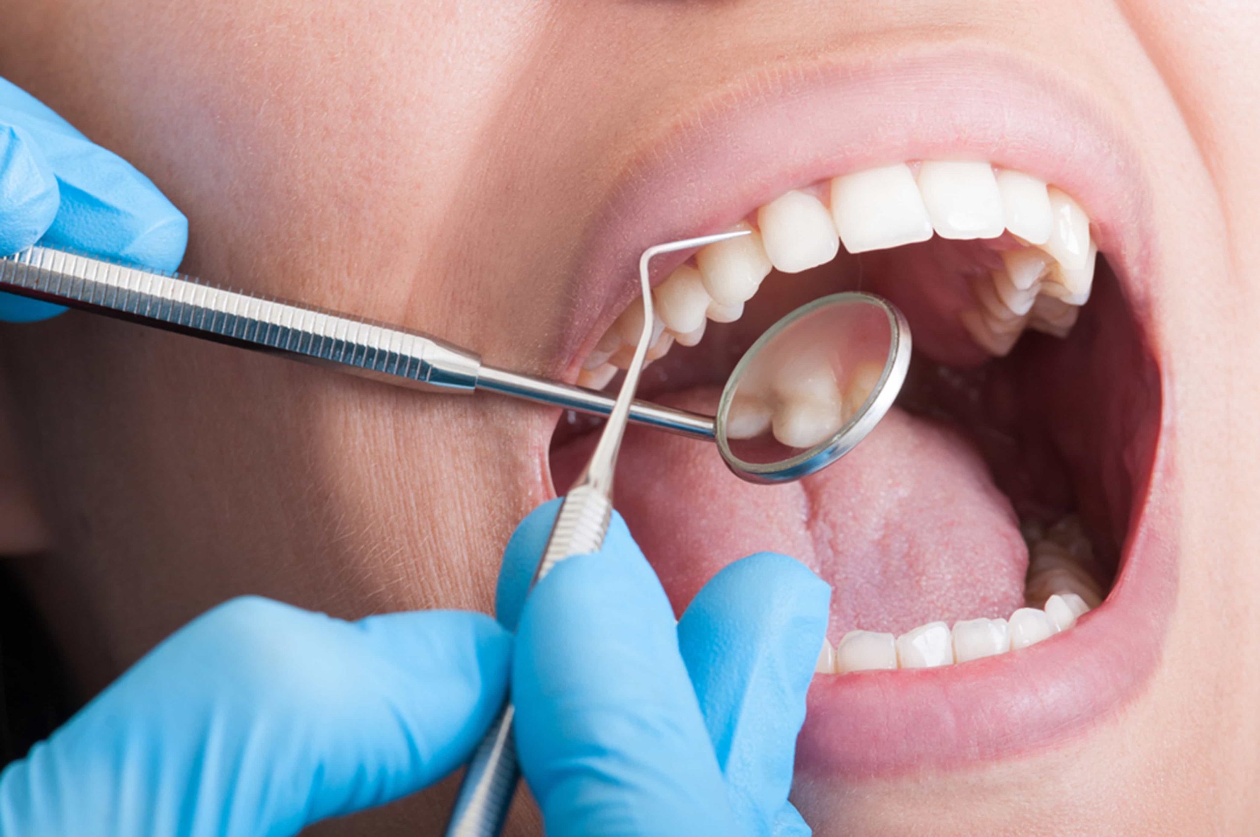 Oral Cancer Screening Scarborough