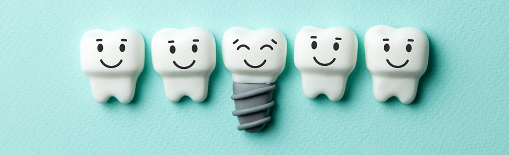 Dental Implants Scarborough