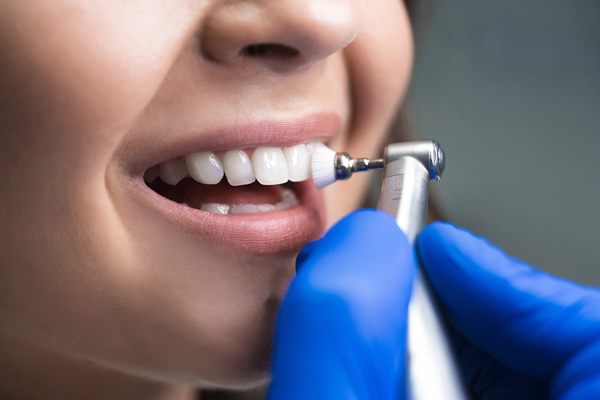 Dental Hygienist Scarborough North Yorkshire
