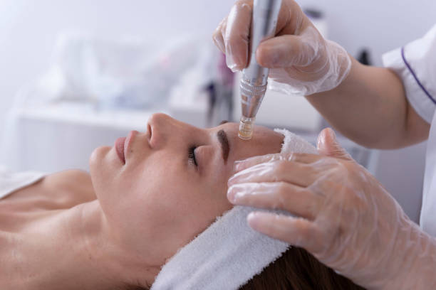 The Raffine microneedling pen, a state-of-the-art device that helps rejuvenate the skin by boosting skin luminosity and improving texture, reducing the appearance of fine lines, wrinkles, and pigmentation.